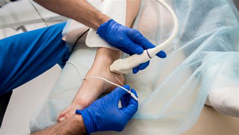 Guide To Endovenous Laser Ablation The Vein Center Of Maryland