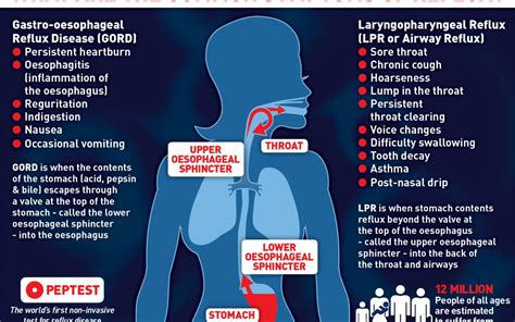 What Is Gastroesophageal Reflux Disease Expert Holistic Health