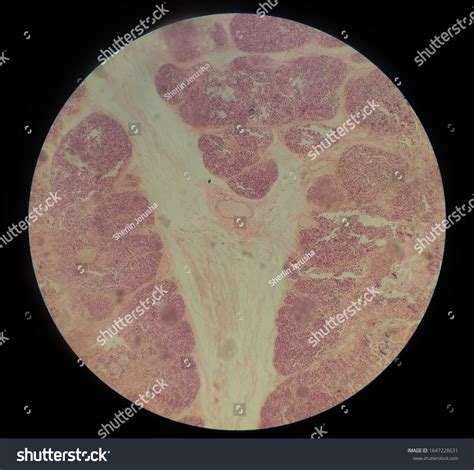 Histology Specimen Human Thymus Gland Under Stock Photo (Edit Now ...