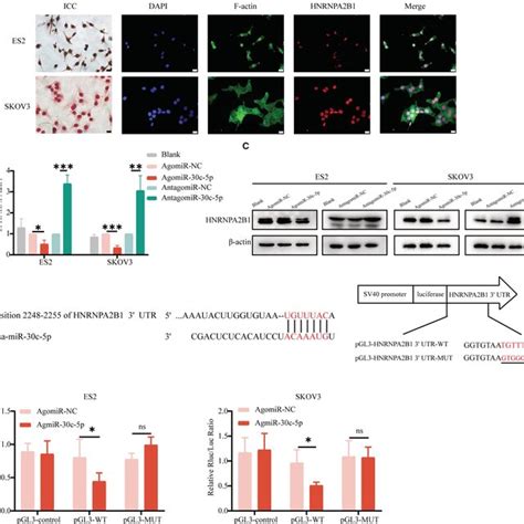 Mir C P Decreases M A Level And Inhibits Ovca Cells Progression In