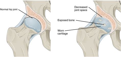 Synovial Joints Anatomy And Physiology I