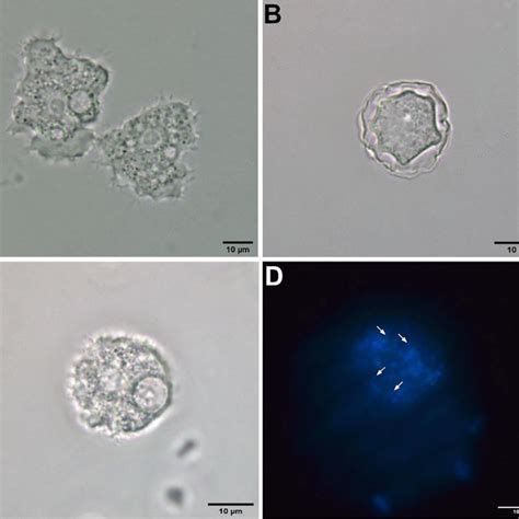 Morphological Analysis Of Acanthamoeba Spp A Trophozoite And B Cyst Download Scientific