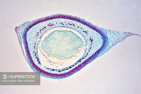 Female Cone Of Pine Pinus Sp Showing Embryo And Endosperm Optical