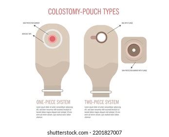 Types Colostomy Bags One Two Pieces Stock Vector Royalty Free