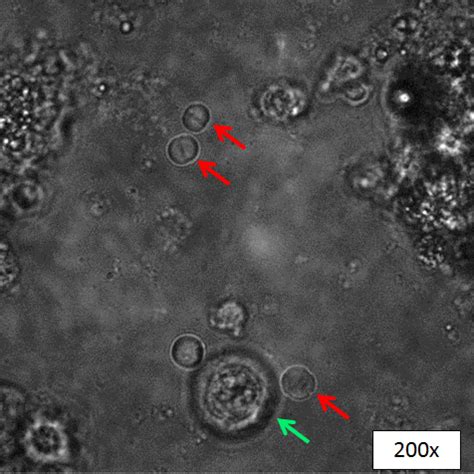 6 questions with answers in CHROMAFFIN CELLS | Science topic