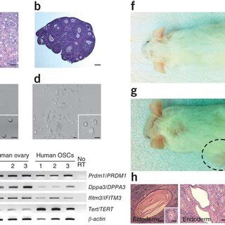 Isolation Of Oscs From Adult Mouse And Human Ovaries A B