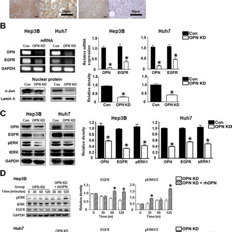 Ihc For Opn And Egfr In Human Hcc Tissue Samples A Representative