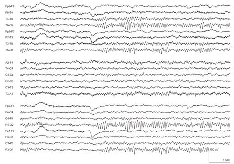 The Eeg Game A Game Based Educational Tool