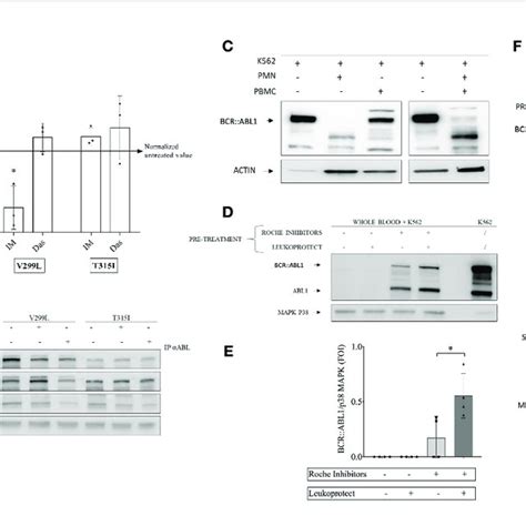 Kinase Assay Optimization And Setup Of A Protease Protection