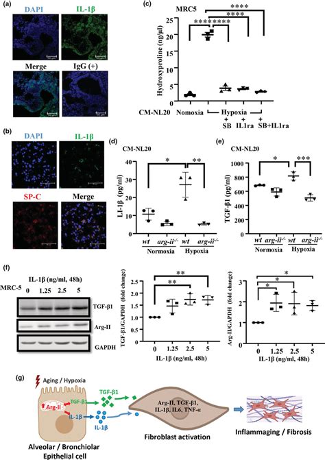 IL1β and TGFβ1 as mediators in crosstalk between epithelial cells and