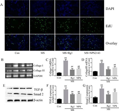 Ginsenoside Rg Inhibited Fibrosis In Cultured Cardiac Fibroblasts A