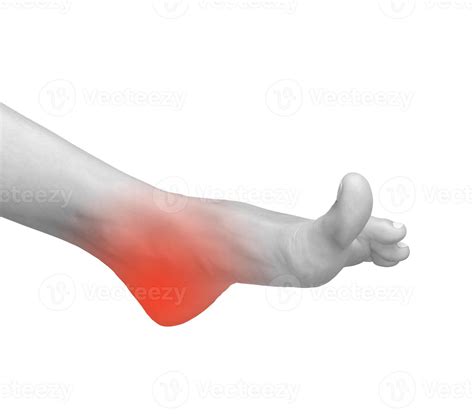 Foot pain and inflammation. Sore heel and joint injury causing chronic