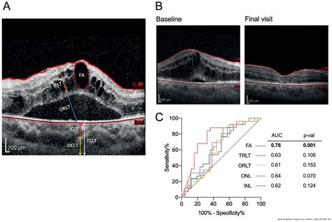 Evaluation Of Marker Based Optical Coherence Tomography Findings In