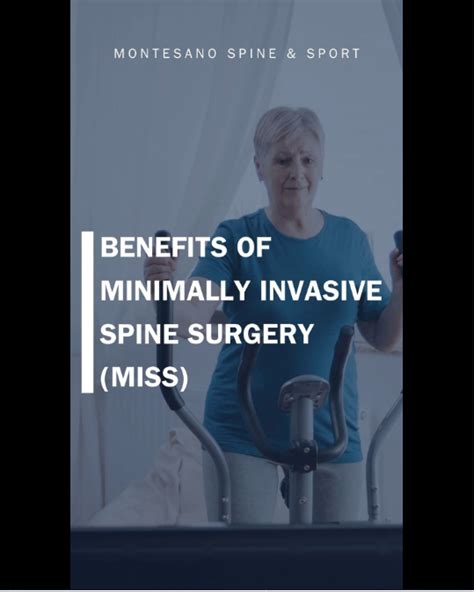 Benefits Of Minimally Invasive Spine Surgery Dr Pasquale X Montesano