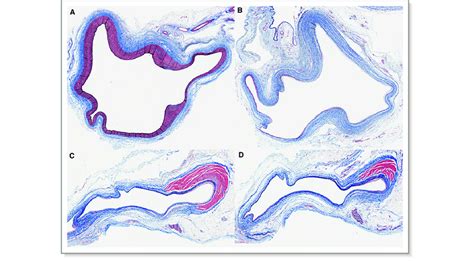 Slide Sections With Elastic Massons Trichrome Stain Demonstrating A