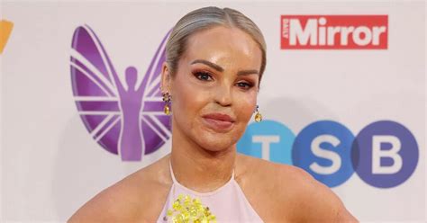 Loose Women S Katie Piper Opens Up On Painful Health Battle To Save Eye After Show Absence