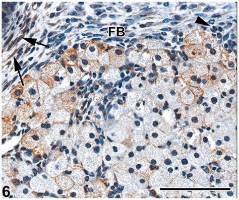 Uterus B6c3f1 Mouse No 1 Granular Cell Tumor At Uterine Cervix Download Scientific Diagram