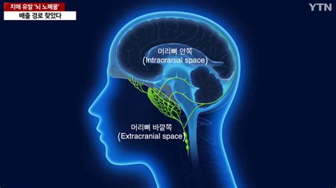 국내에서 세계최초로 치매 유발 뇌 노폐물 배출 경로 찾았다 미스터리공포 에펨코리아