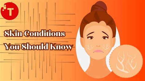 What Are the Skin Conditions That You Should Know About