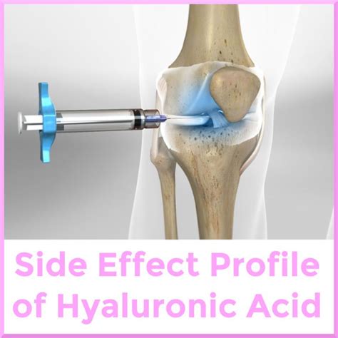 Side Effects Of Intra Articular Knee Hyaluronic Acid Injection Sports