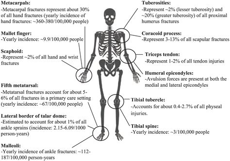 A Narrative Review On Avulsion Fractures Of The Upper And Lower Limbs