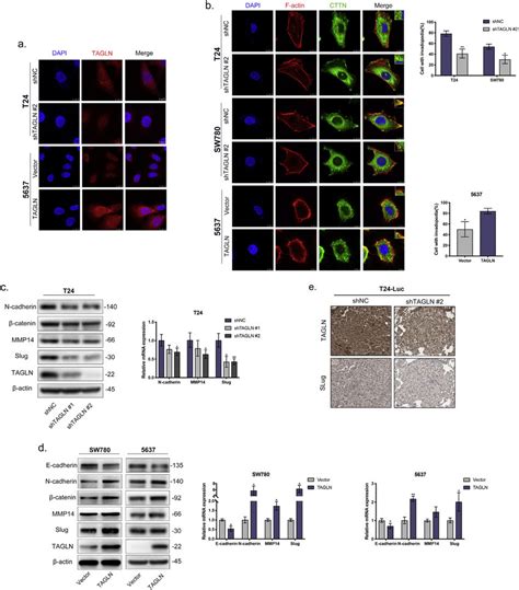 Tagln Promotes Invadopodia Formation And Emt A Representative