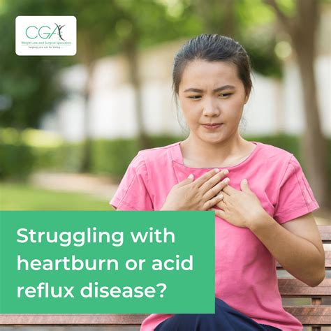 How To Prevent Acid Reflux And Gerd Artofit