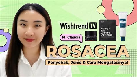 Apa Itu Rosacea Yuk Kenali Penyebab Jenis And Cara Mengatasinya Ft