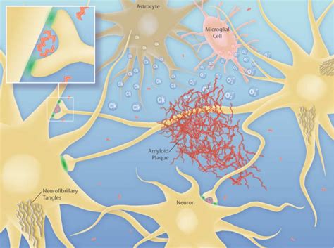 Figure From Deciphering The Molecular Basis Of Memory Failure In