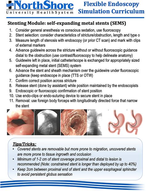 Printable Step By Step Procedure Card For Endoscopic Stenting