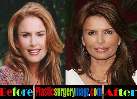 Roma Downey Plastic Surgery Before and After | | Plastic Surgery Magazine