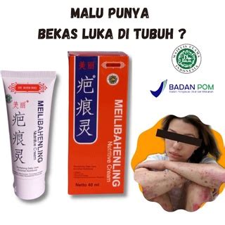 Jual Melibahenling Salep Bekas Luka Original Penghilang Bekas Luka Lama