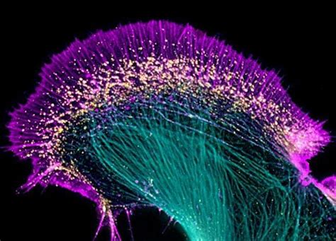 Pin by Tux Man on Графический дизайн Neurons Microscopic photography