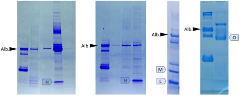 Diagnostics | Free Full-Text | SDS Electrophoresis on Gradient ...
