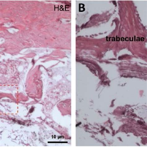 Histology Showing Tissue And Polylactidecarbon Fiberalginate