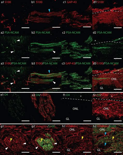 Confocal Fluorescent Micrographs Showing Sagittal Cryosections Of Ad