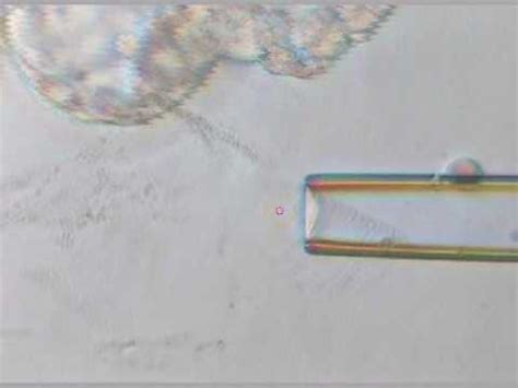 Trophectoderm biopsy with laser - YouTube 