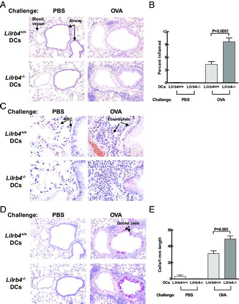 Effects Of Transferred Lilrb4 And Lilrb4 2 2 BMDCs On Lung