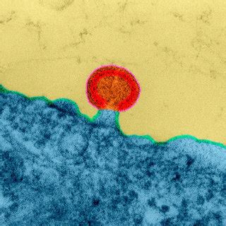 HIV Infection Coloured Transmission Electron Micrograph TEM