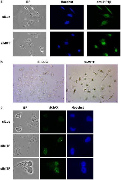 The Sirna Mediated Knockdown Of Mitf Leads To Senescence And Activation