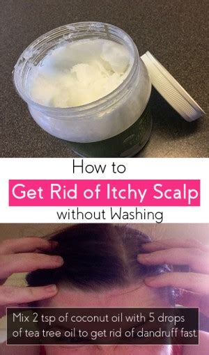 How To Get Rid Of Itchy Scalp Without Washing Hair 5 Diy Recipes