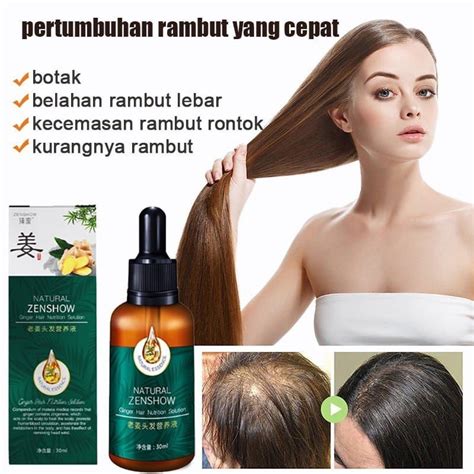 Jual Hanya 7 Hari Serum Penumbuh Rambut Cepat Hair Oil Rambut Rontok