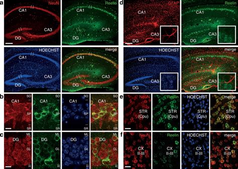 Double Immunohistofluorescence Staining In Tissue Sections From Adult