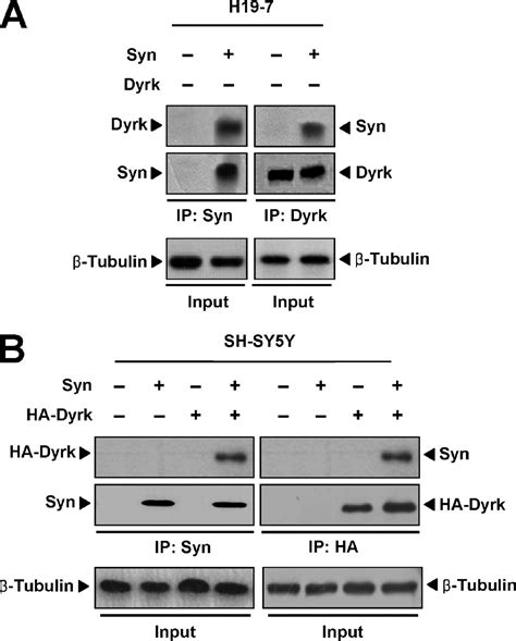 Dyrk1A Phosphorylates α Synuclein and Enhances Intracellular Inclusion