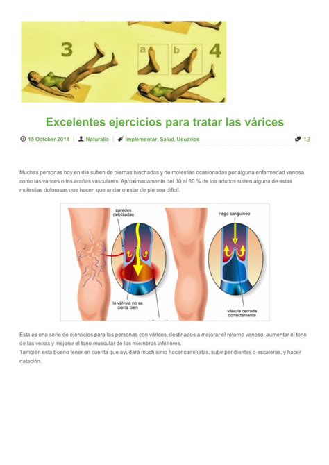 PDF Excelentes Ejercicios Para Tratar Las Várices La Bioguía