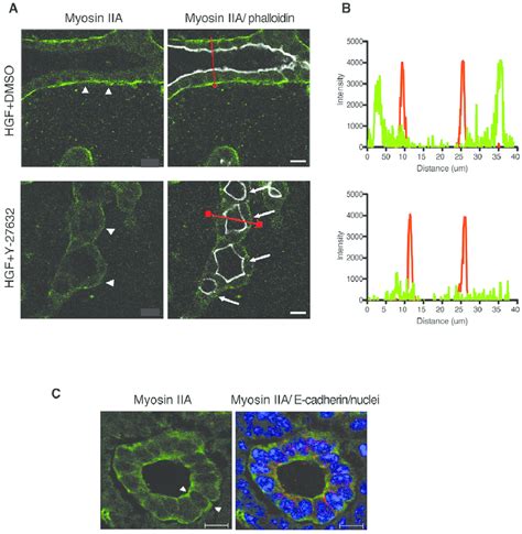 Rock Inhibition Attenuates The Localization Of Myosin Iia At The Basal