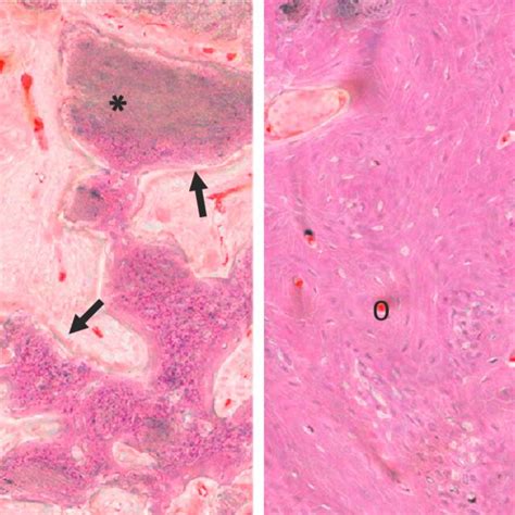 Micrographs Of Octacalcium Phosphate OCP Implanted Tibial Defect In