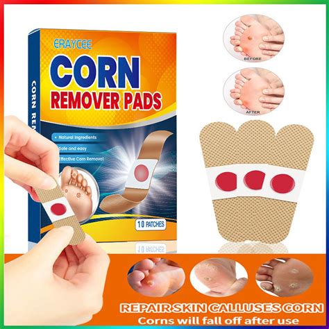 Jual 10PCS Plaster Kutil Set Plester Mata Ikan Foot Corn Removal