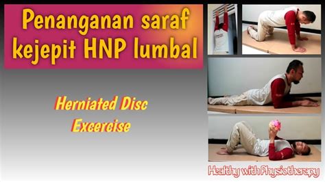 Fisioterapi Cara Mengobati Saraf Kejepit HNP Lumbal Herniated Disc