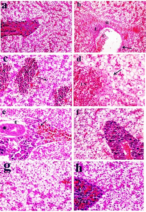 H E Stained Sections Of Hepatopancreas Of Nile Tilapia Fed With A Of